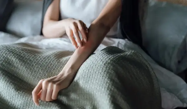 bed-bugs-for-landing-page Bed bug bites